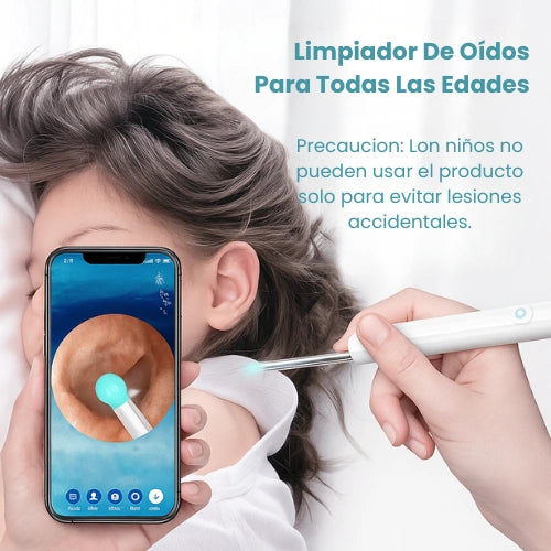 Limpiador De Oidos Con Camara - Tu Limpieza Auditiva Con Inteligencia.